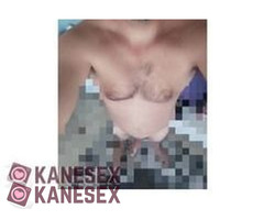 πρησμένα αρχιδια - Εικόνα 5