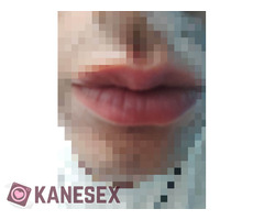 Μποτομ - Εικόνα 2