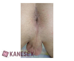 Αδυναμία στα κωλαρακια - Εικόνα 6