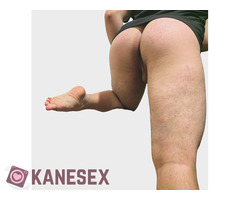 Θέλω ξεσκισμα - Εικόνα 6