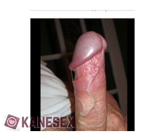 ΑΜΕΑ ΑΝΑΖΗΤΑΙ ΠΑΘΗΤΙΚΌ  ΓΙΑ ΠΡΩΗΝΗ ΣΥΝΆΝΤΗΣΗ