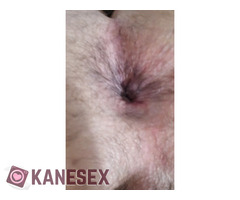 Καυλωμένη τρύπα