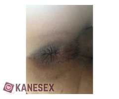 ΜΑΡΕΣΕΙ ΝΑ ΤΟΝ ΓΕΜΙΖΩ ΣΑΛΙΑ!! - Εικόνα 4