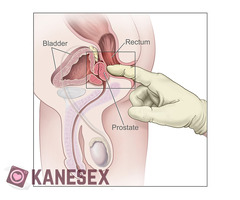 ΜΑΣΑΖ ΠΡΟΣΤΑΤΗ