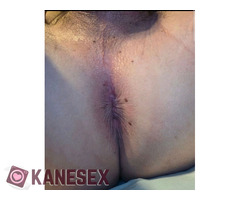 Για τωρα - Εικόνα 4