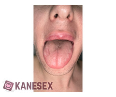 τρωω αντρικο σκατο