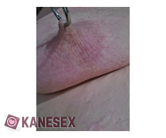 Σπέσιαλ περίπτωση - Εικόνα 4