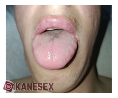 αντρικο κατουρο