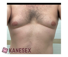 Παρέαγυμνισμός!!!