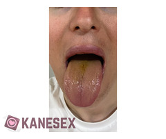 πινω κατουρο