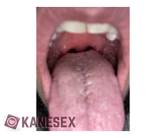 Για 45 και πανω