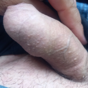 9 cm